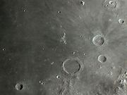 SINUS LUNICUS.